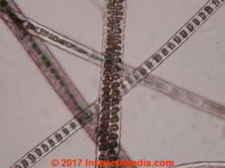 Rabbit hair under the microscope (C) Daniel Friedman